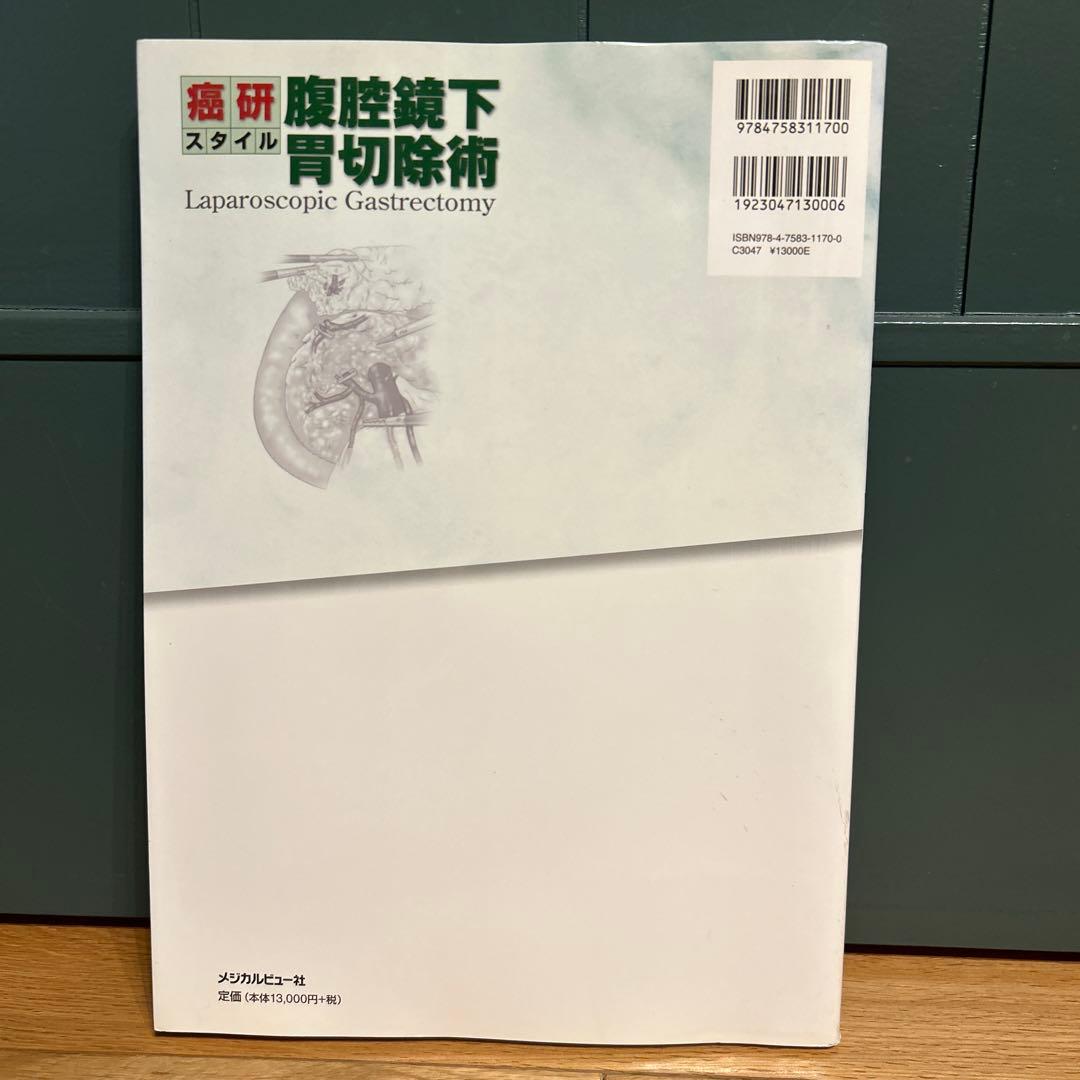 腹腔鏡下胃切除術 癌研スタイル