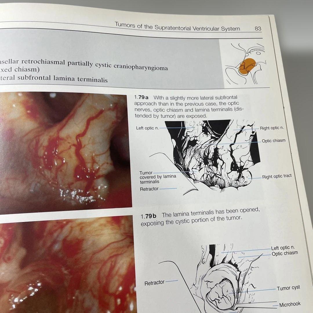健康・医学 Color atlas of microneurosurgery