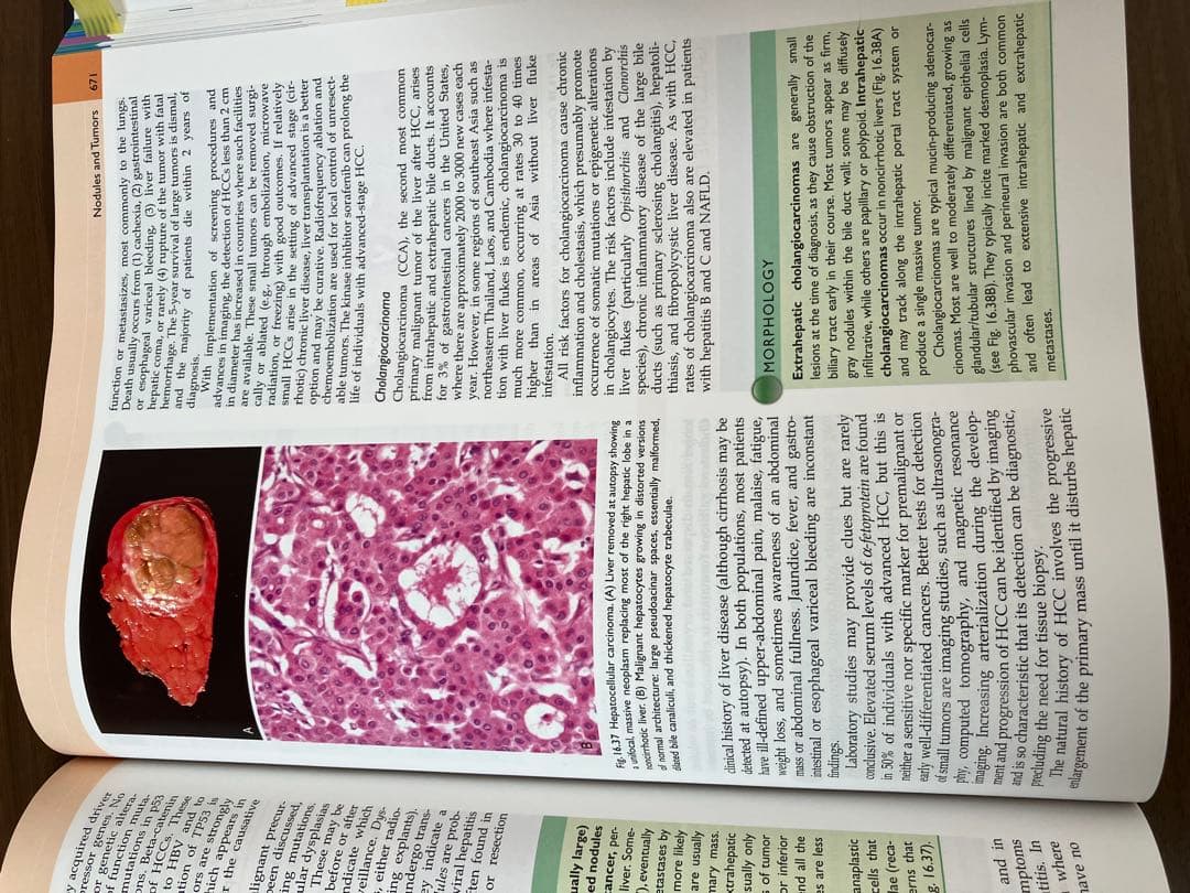 Robbins Basic Pathology 第10版