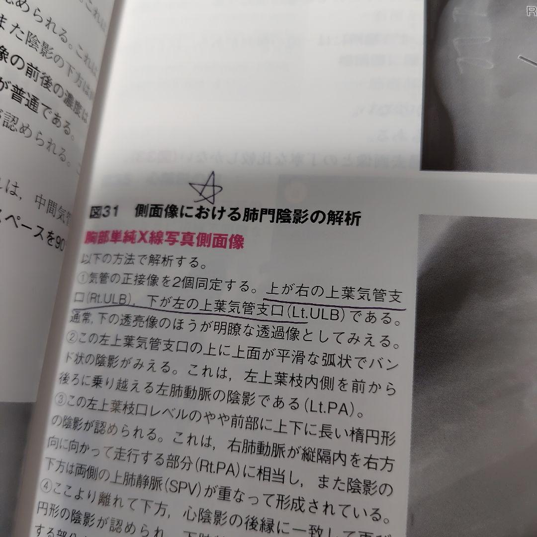 【未裁断】胸部 画像診断の勘ドコロNEO