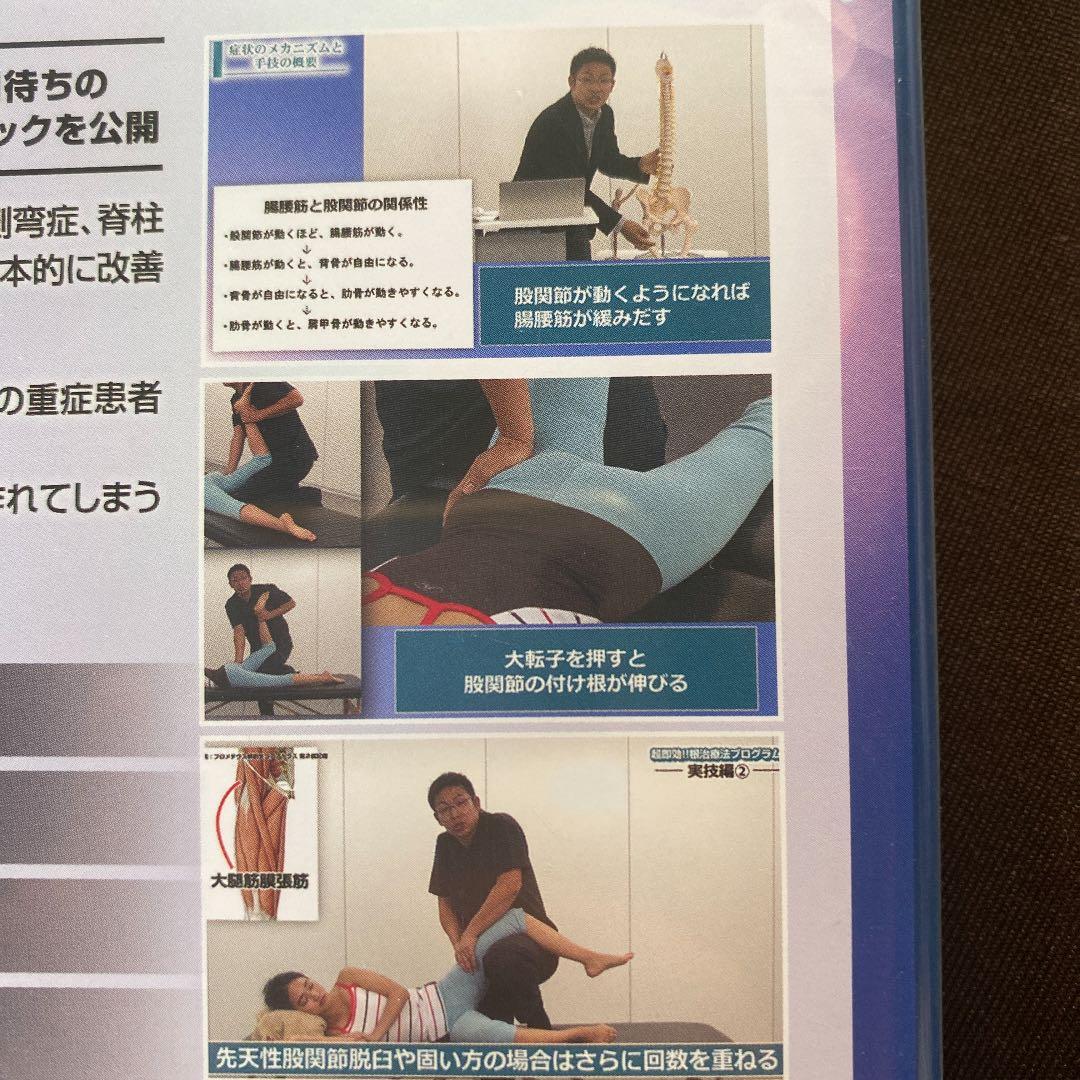 星野高宏の根治療法プログラム　DVD 3枚