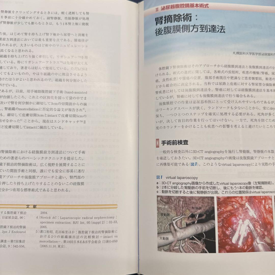 泌尿器腹腔鏡手術 ベーシックテクニック