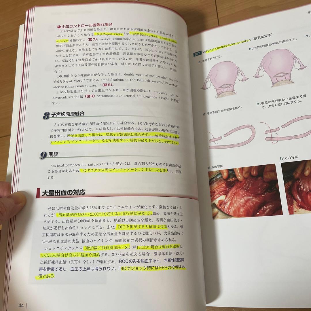 前置胎盤・前置癒着胎盤の手術 : 入念な準備で危機に対処