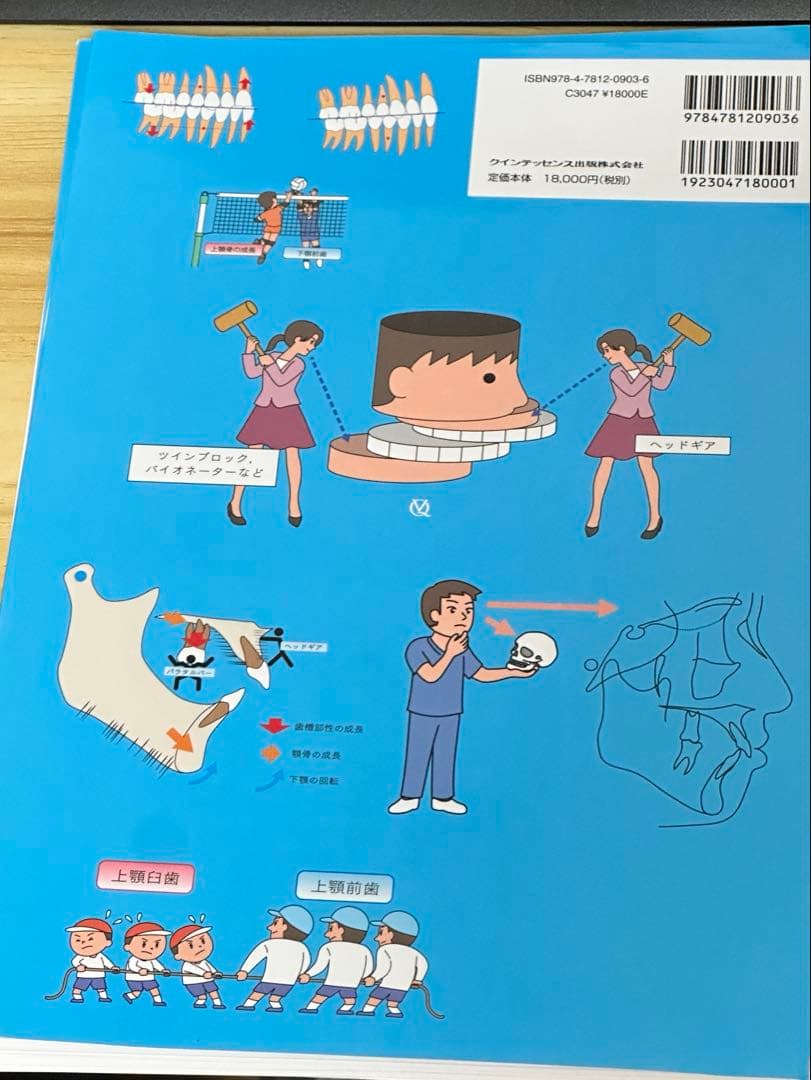 「裁断済み」図解 矯正治療が面白いほどわかる本