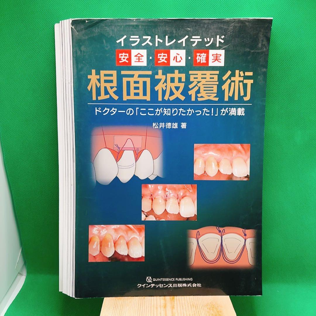 【裁断済】イラストレイテッド 根面被覆術