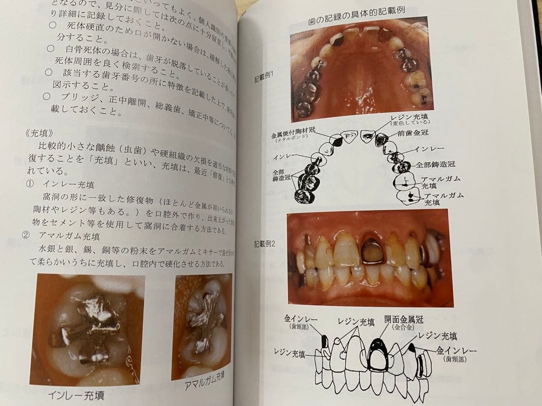 『検視のてびき』福岡県検視業務研究会 編 （部内用・入手困難資料）