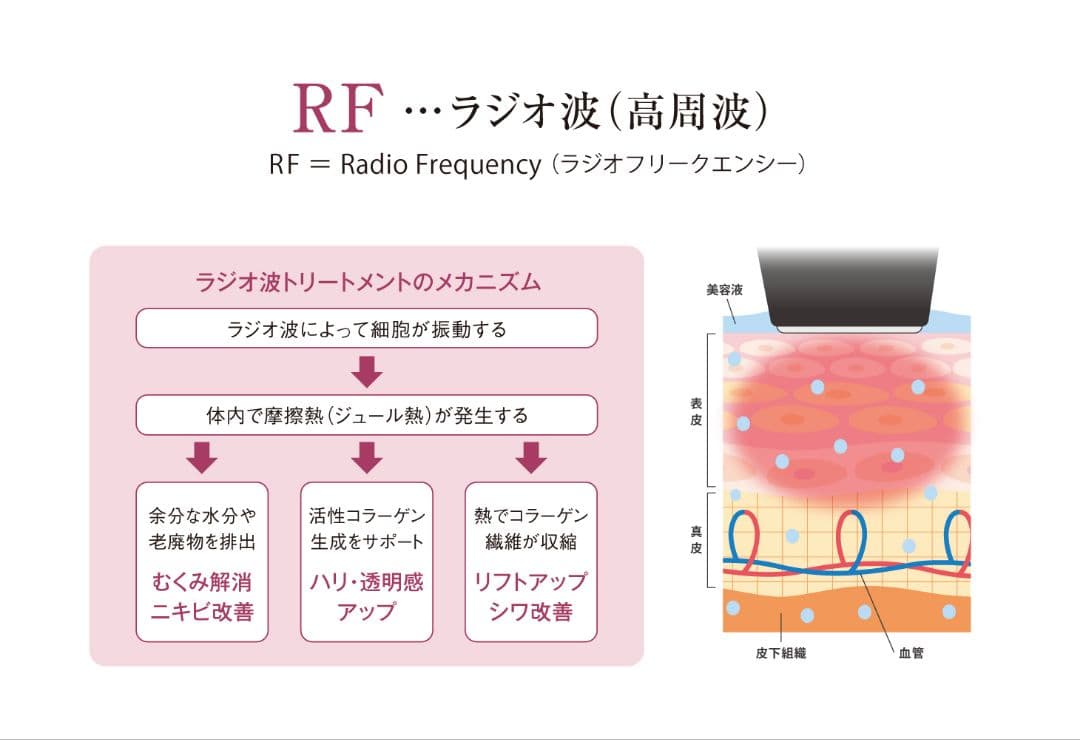 CBS ICR Beauty ミニキュア エクセレント シービーエス 美顔器