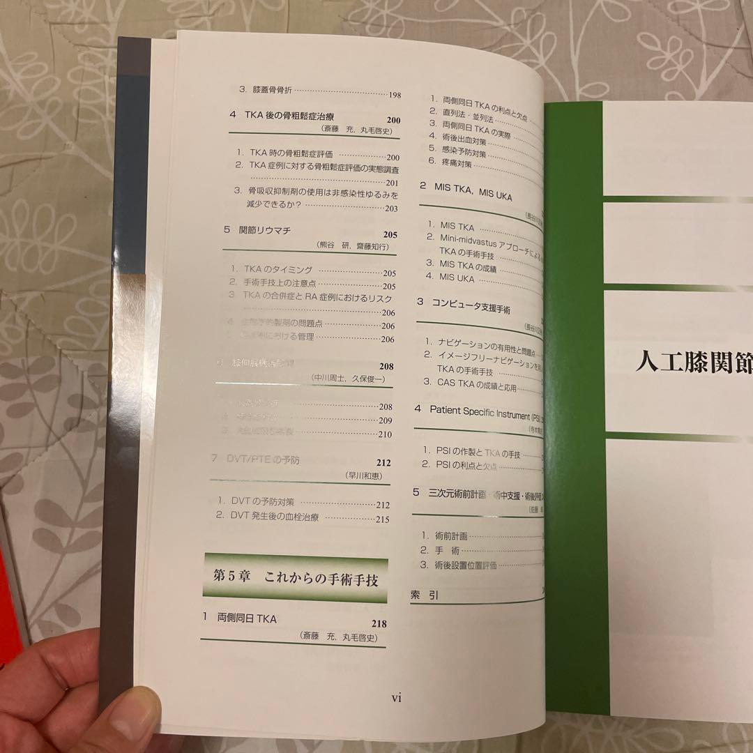 パーフェクト 人工膝関節置換術