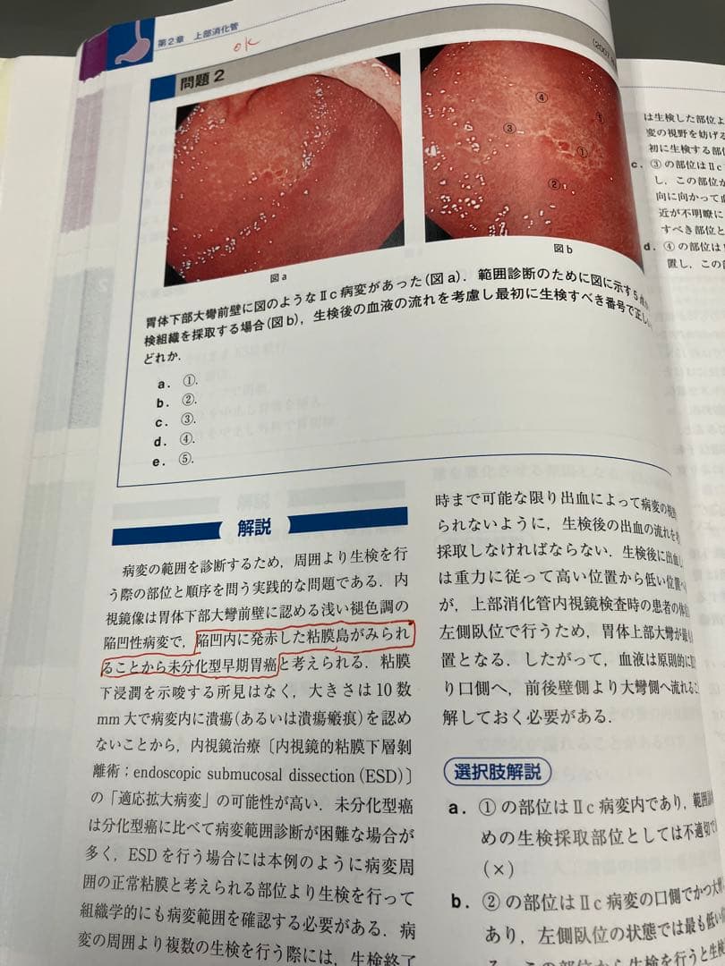 日本消化器内視鏡学会専門医学術試験問題