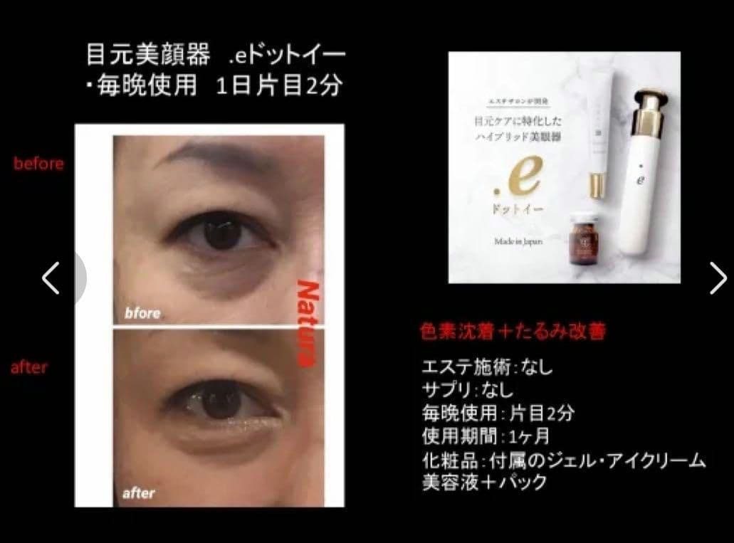 格美品 .e ドットイー　ナトゥーラ　Natura 目元専用美眼器