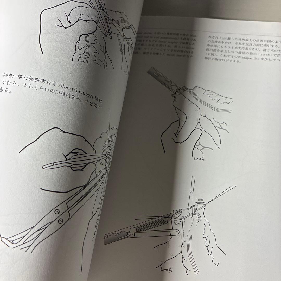 【絶版　美品】イラストレイテッド外科手術 : 膜の解剖からみた術式のポイント